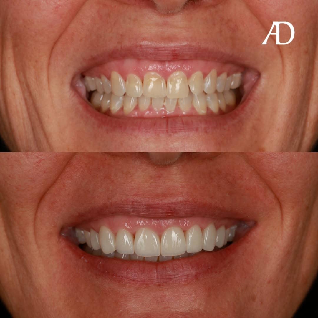 Avenue Dental Adelaide West gallery image 2