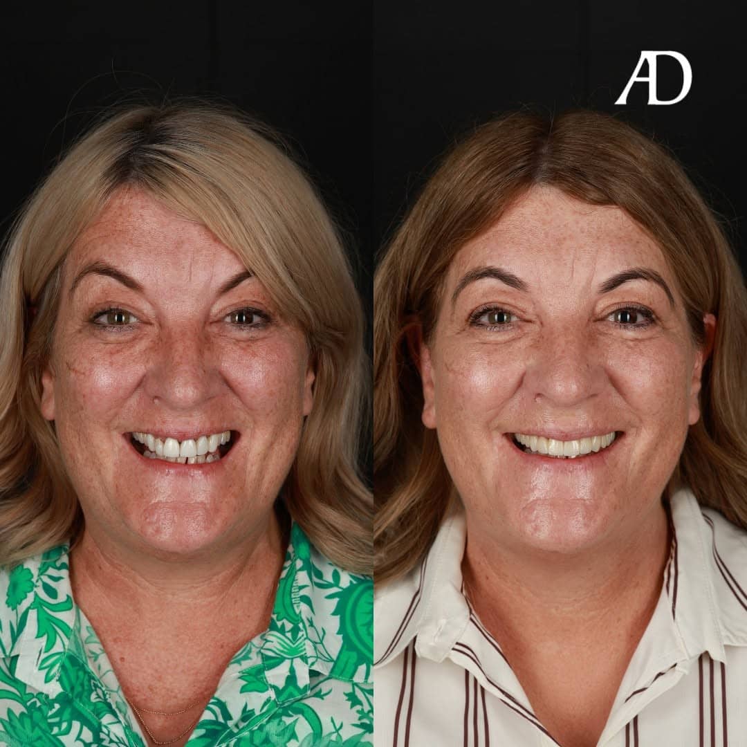 Avenue Dental Adelaide West gallery image 3