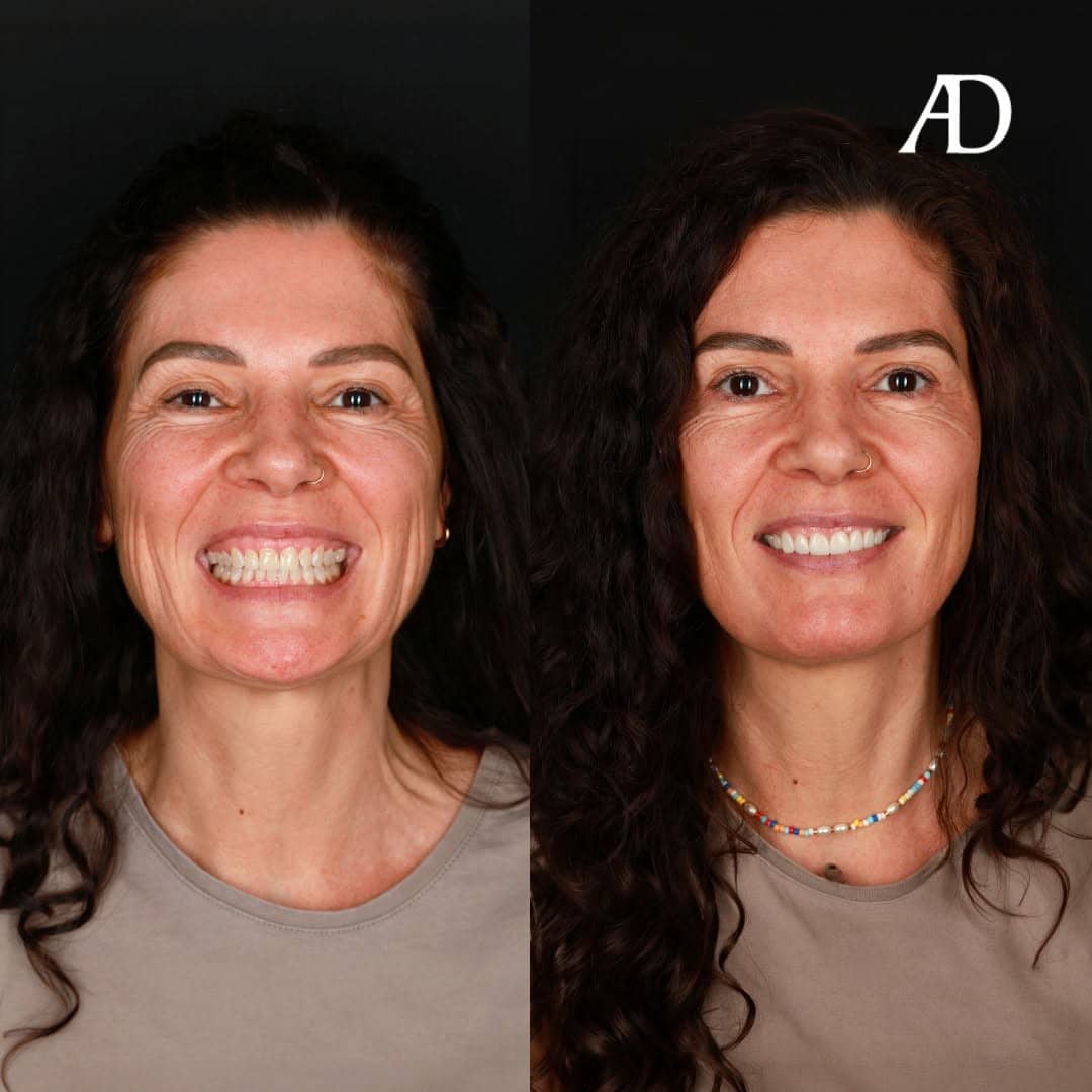 Avenue Dental Adelaide West gallery image 5