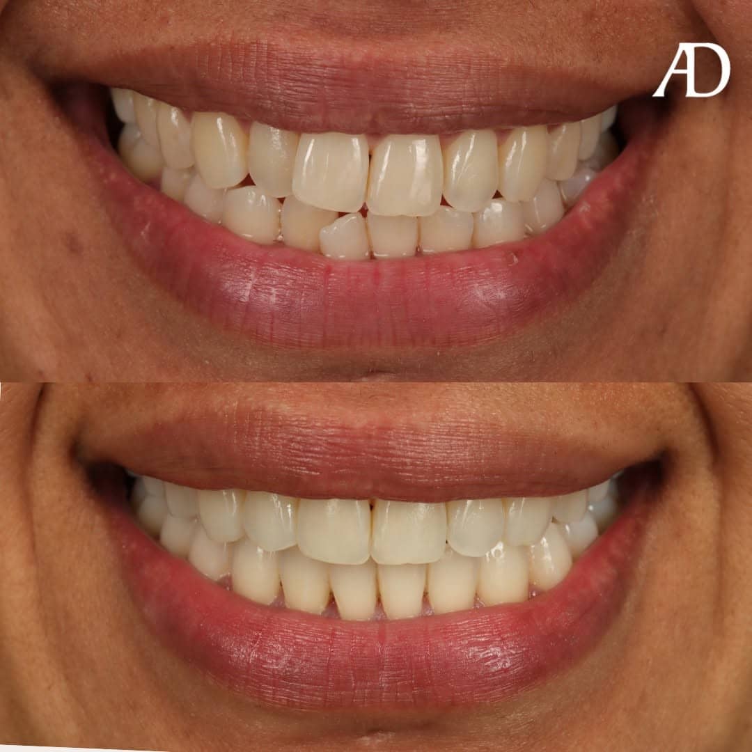 Avenue Dental Adelaide West gallery image 6