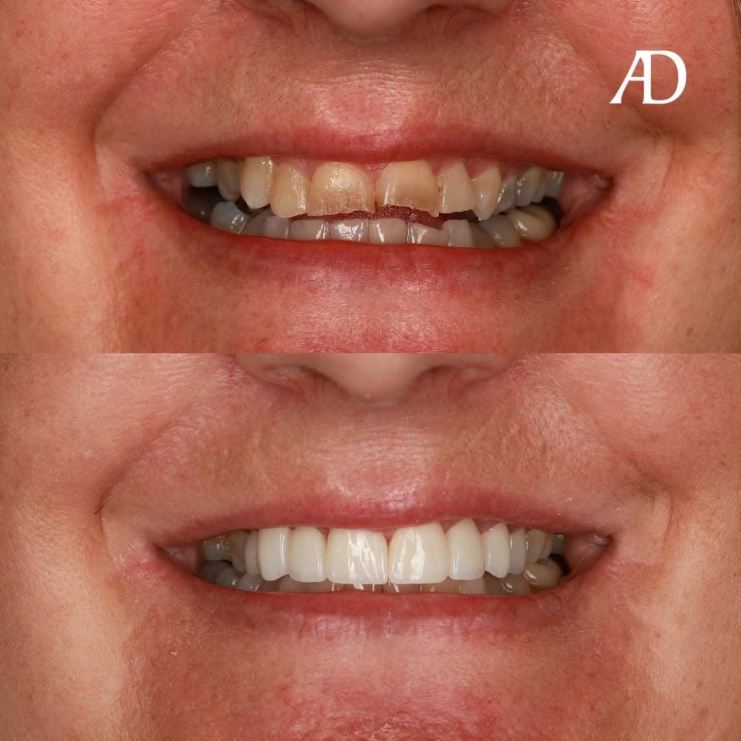 Avenue Dental Adelaide West gallery image 7