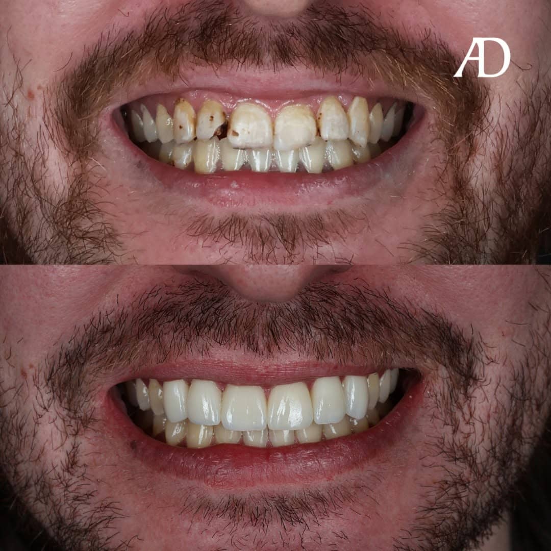 Avenue Dental Adelaide West gallery image 8