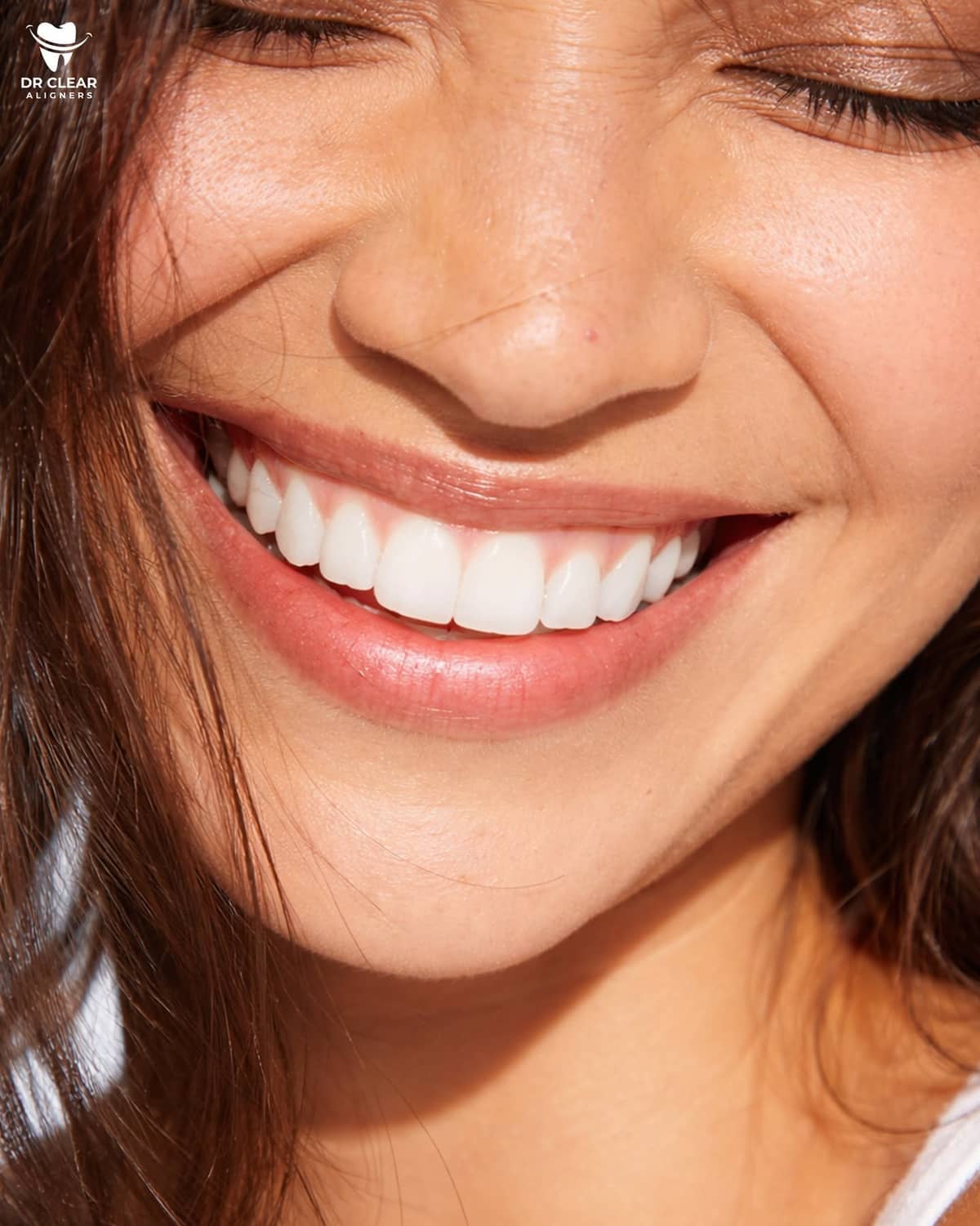 Dr Clear Aligners gallery image 7