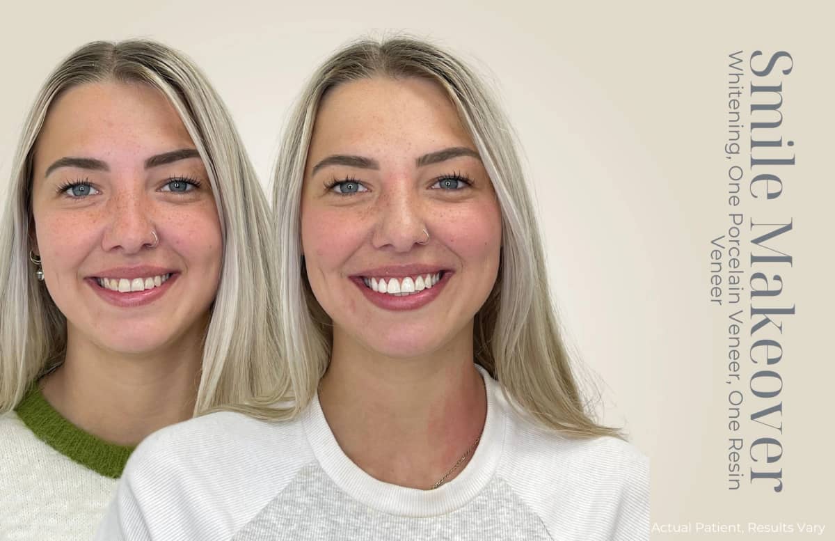 Adelaide Cosmetic Dentistry - Image 4