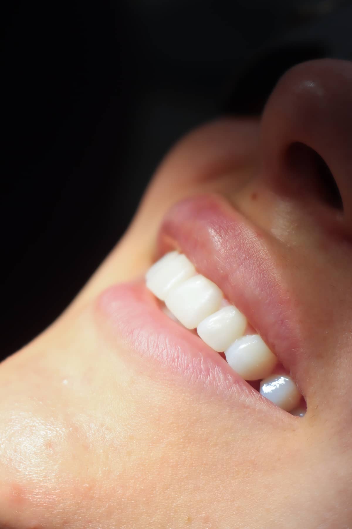 Luminaire Dental - Image 6