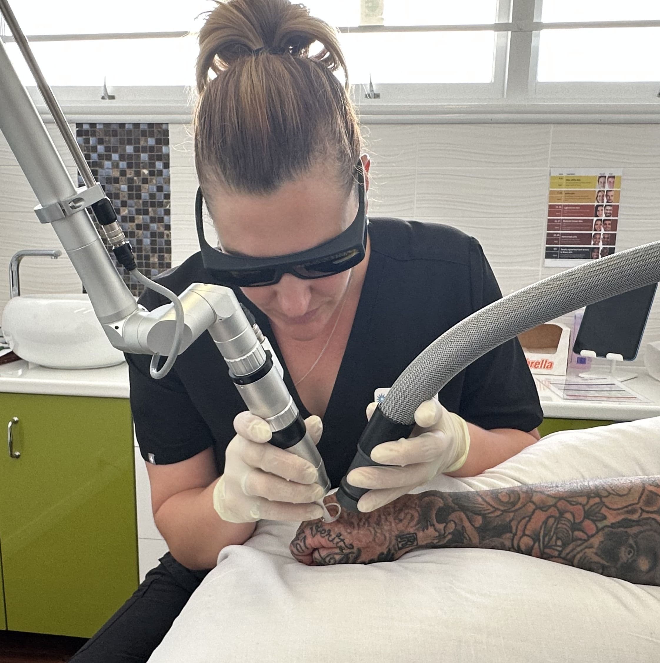 Best Tattoo Removal wedding vendor